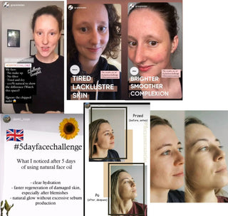 Results 2 - Calendula and Geranium Facial Oil 4ml #5dayfacechallenge